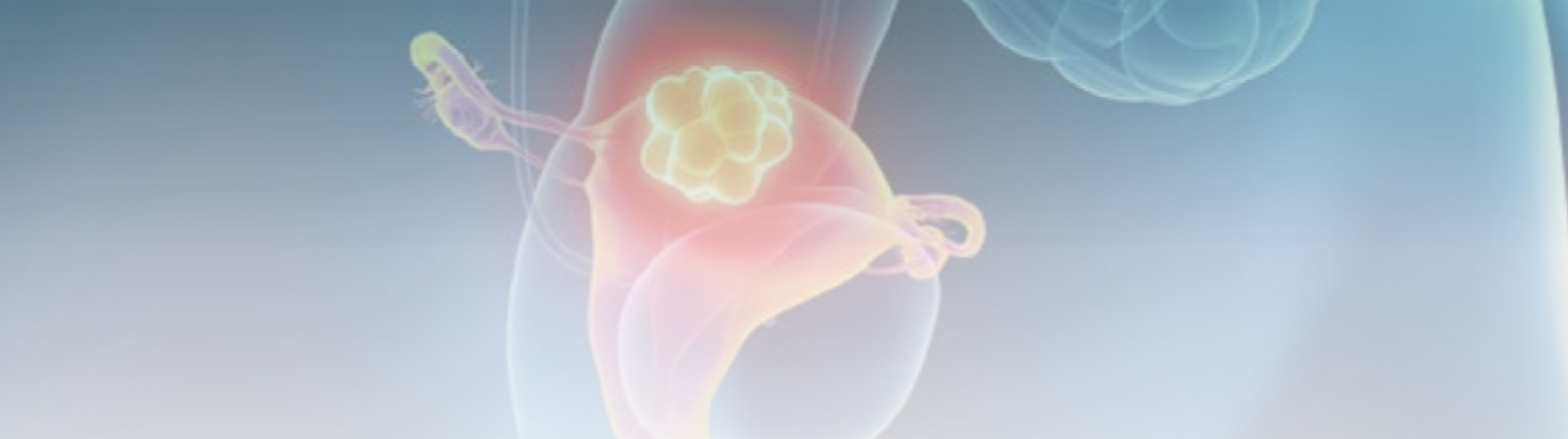 Rastreamento e vacinação como estratégias para prevenção do câncer de colo uterino