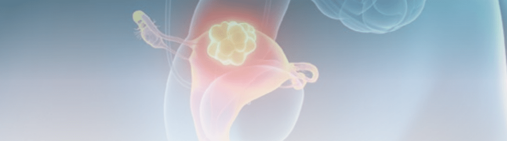 Rastreamento e vacinação como estratégias para prevenção do câncer de colo uterino