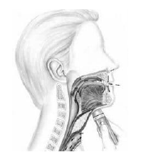 Esquema de laringe eletrônica em paciente laringectomizado