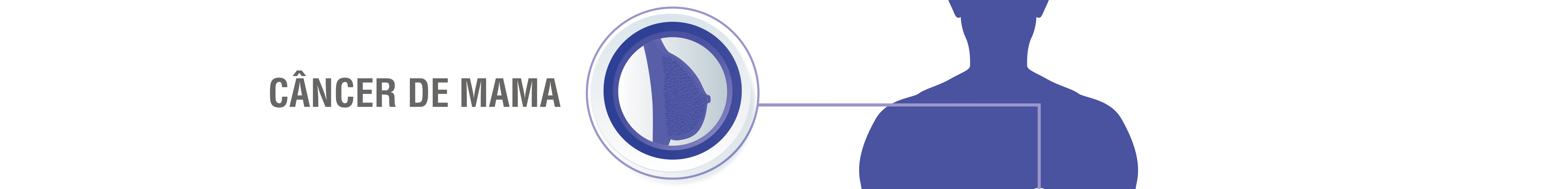 Câncer de mama
