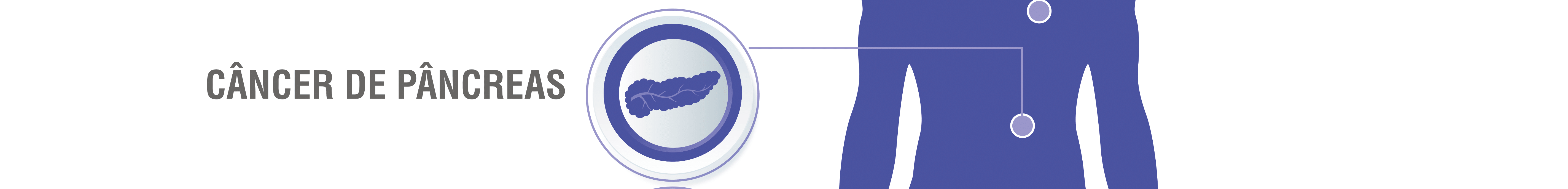 Câncer de Pâncreas