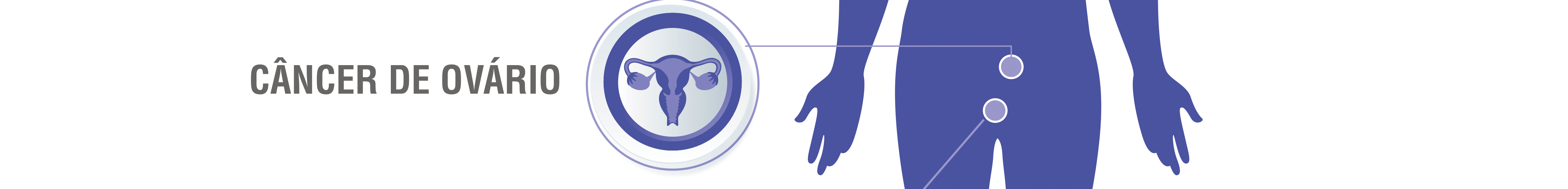 Câncer de ovário