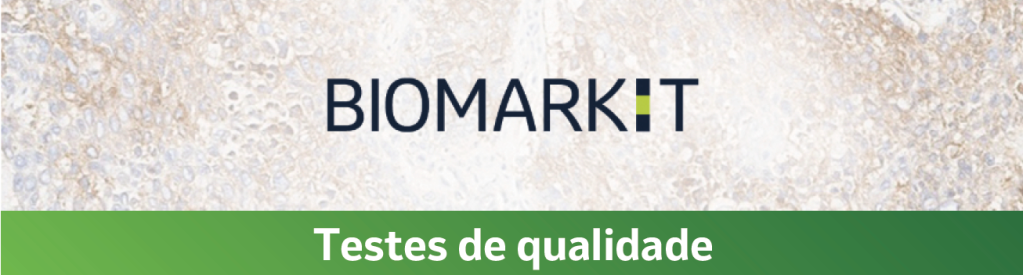 Testes de qualidade