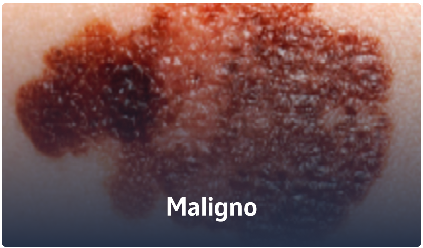 C - Maligno