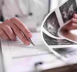 Estadiamento:

avaliação do
estágio do câncer.2